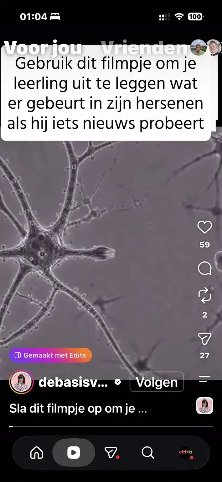 Microscope video frame showing a branching neuron-like cell structure